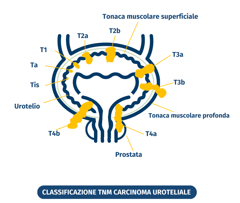 tonaca muscolare superficiale
